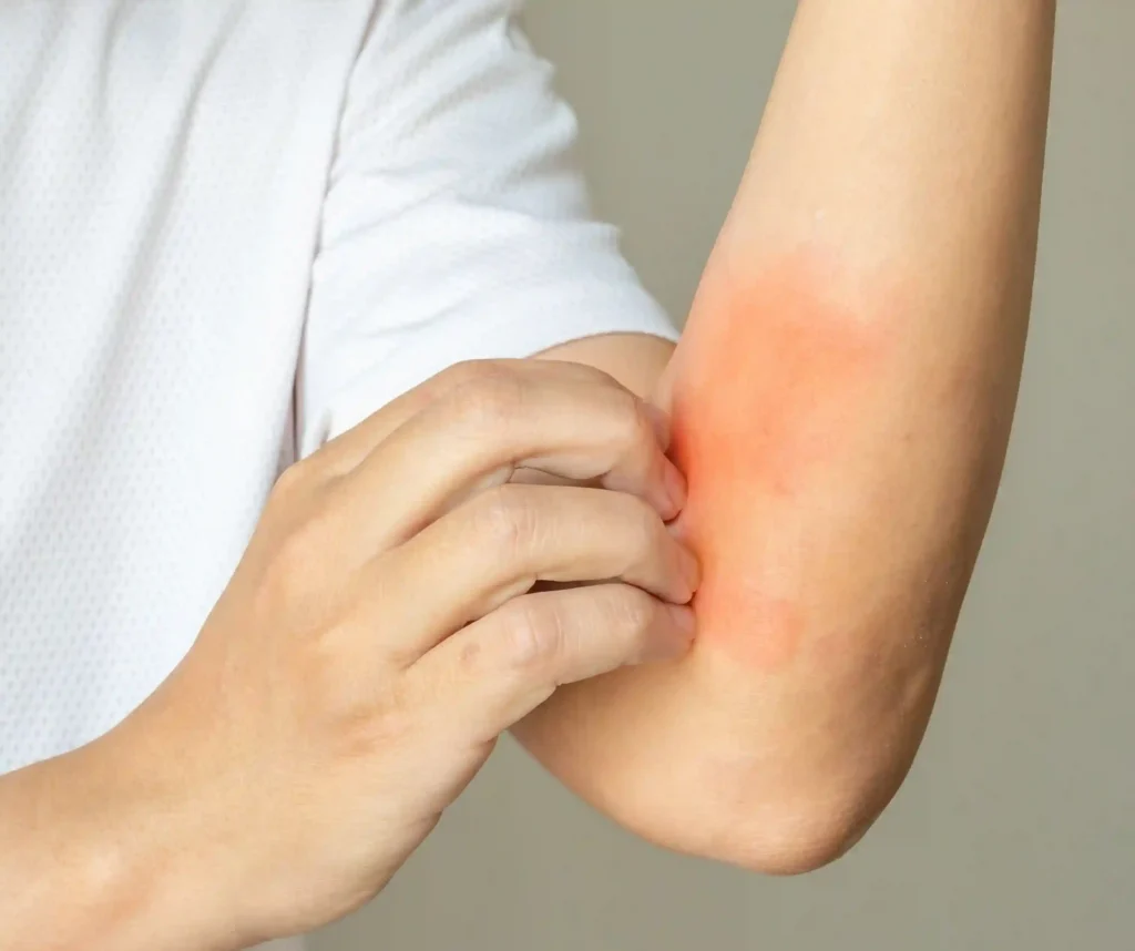 Allergic Reactions & Asthma Attacks