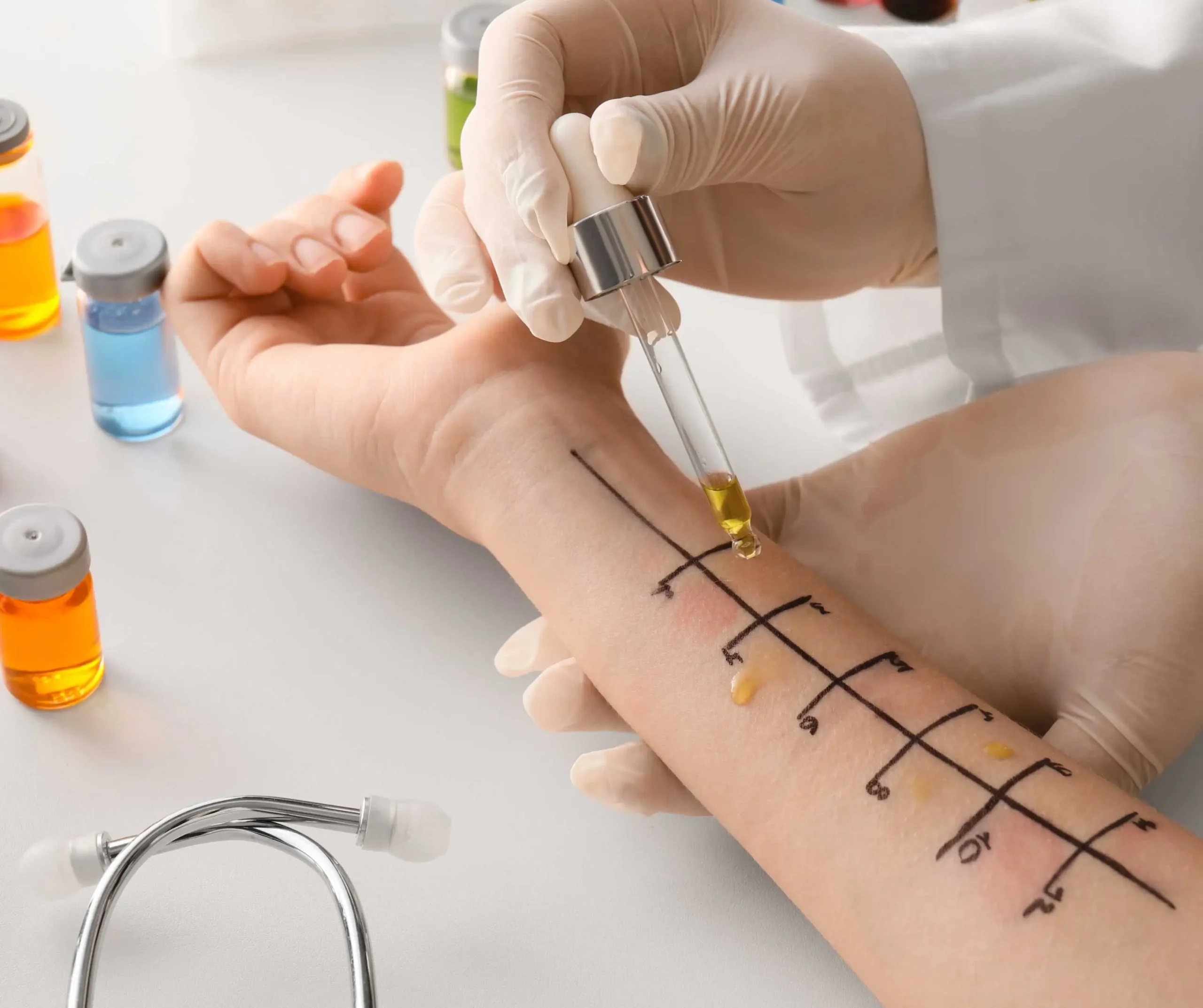 Allergy and Sensitivity Test