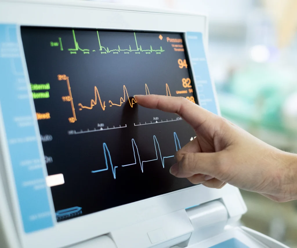 EKG reading for an irregular heartbeat at Plano ER