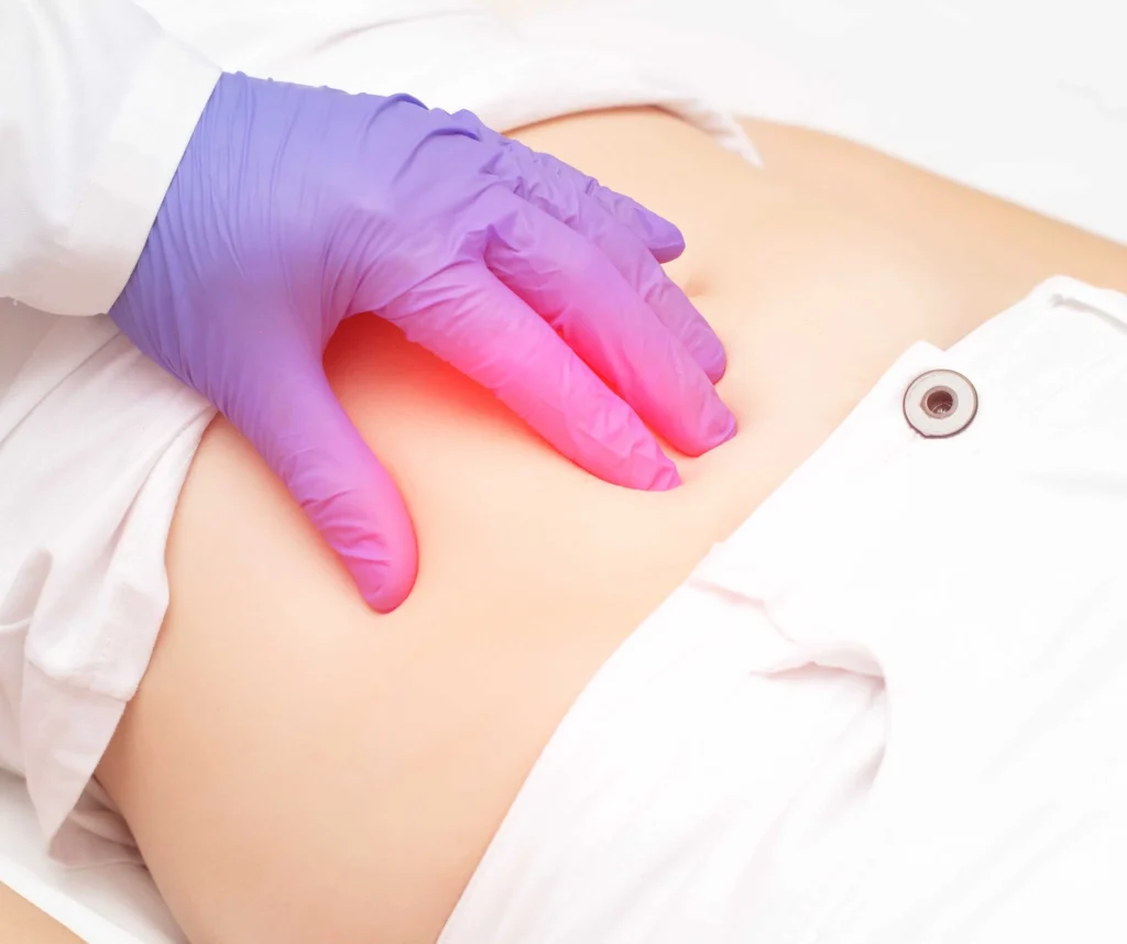 How We Diagnose & Treat Appendicitis