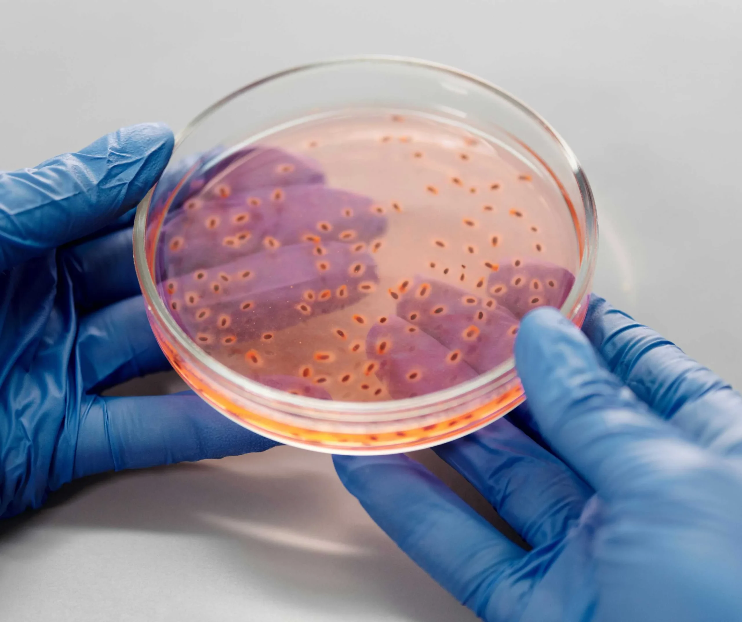 Infection Test