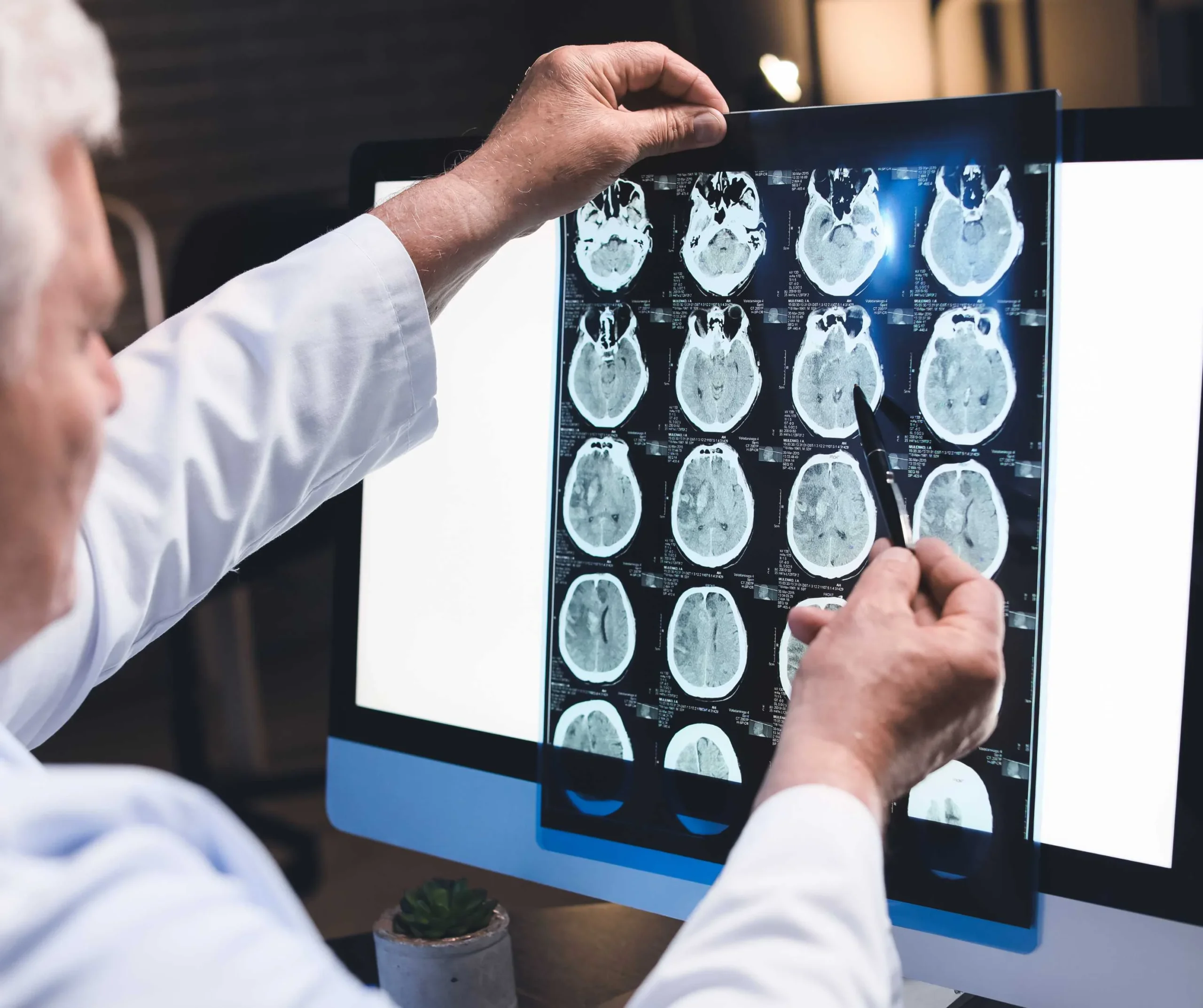 Onsite imaging and CT scan