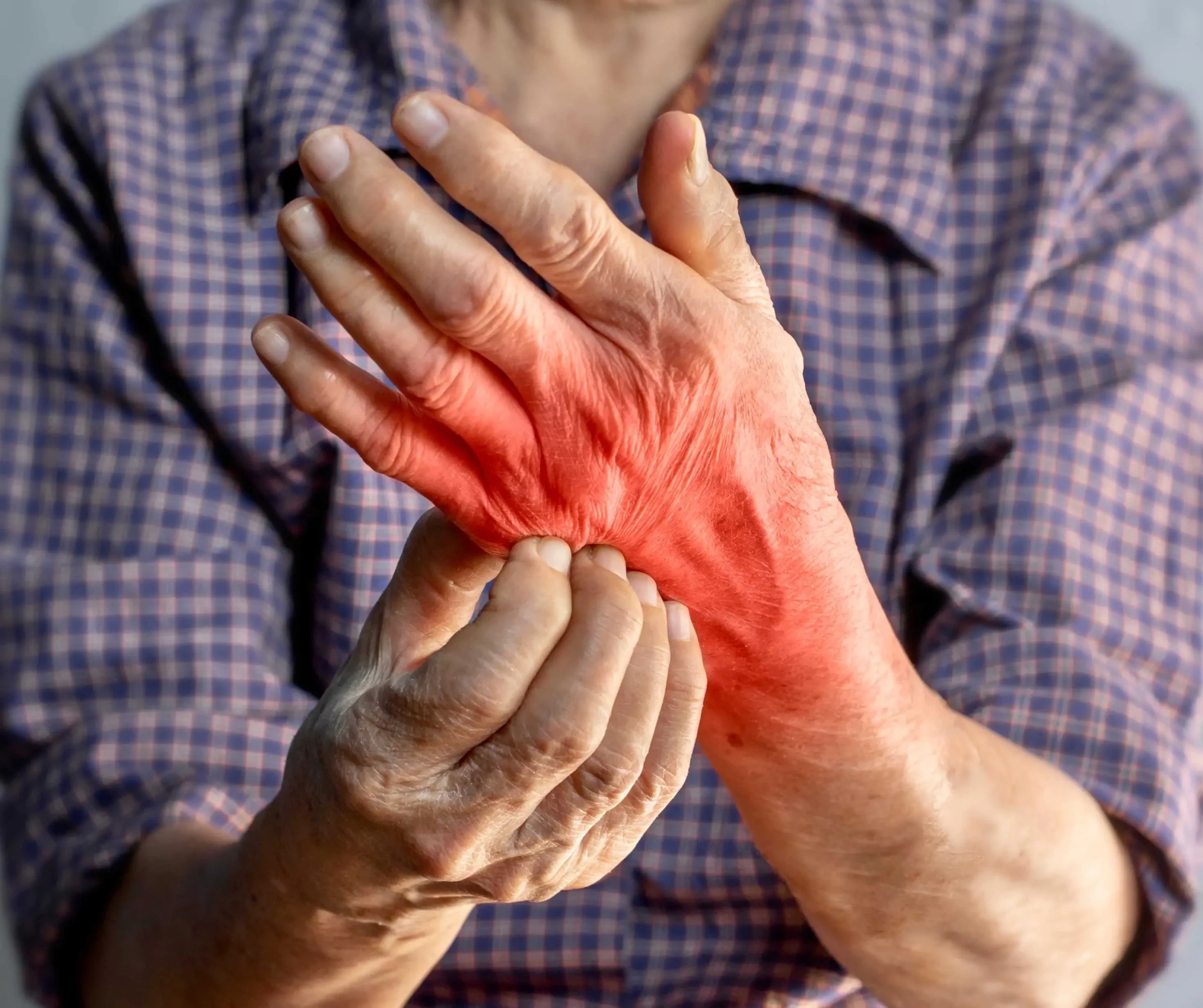 Unexplained Rashes