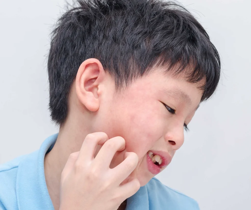 What Causes a Rash