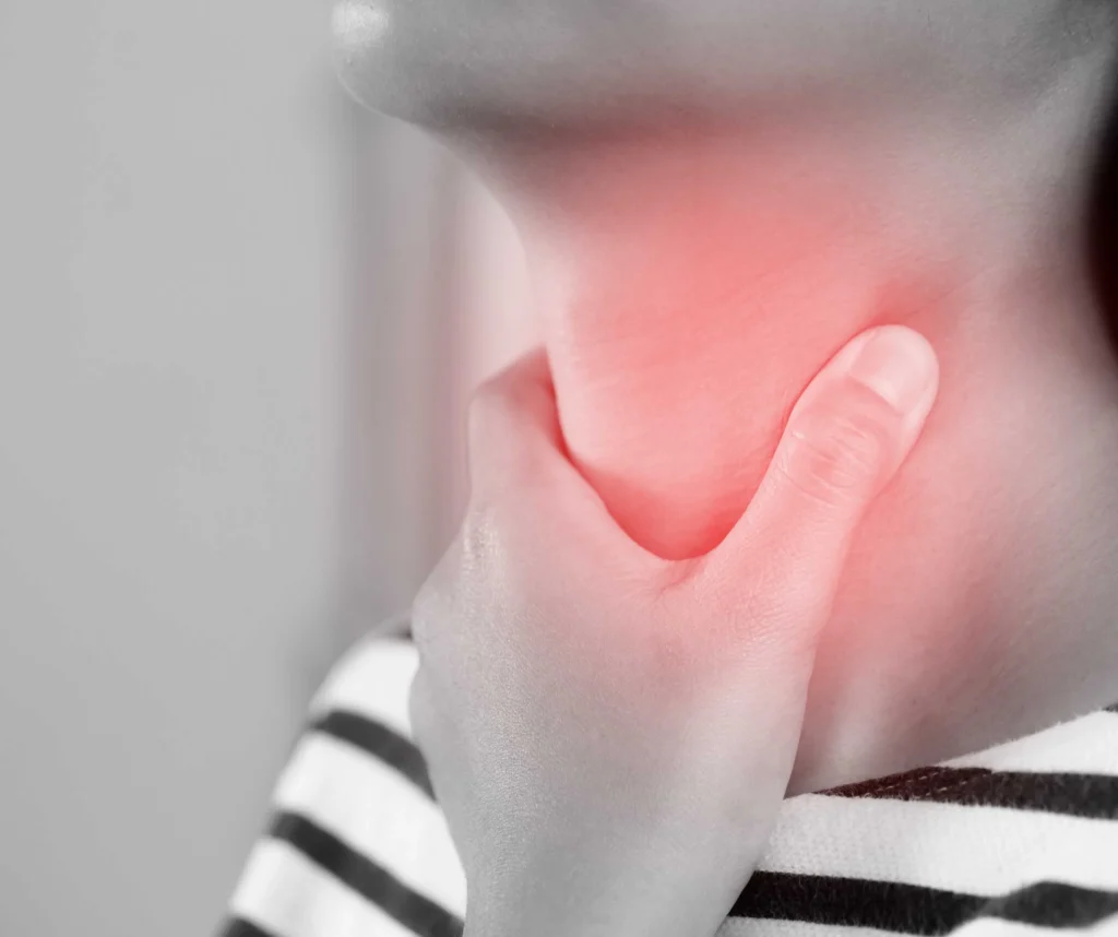 What Is Strep Throat and Why It Needs Immediate Attention