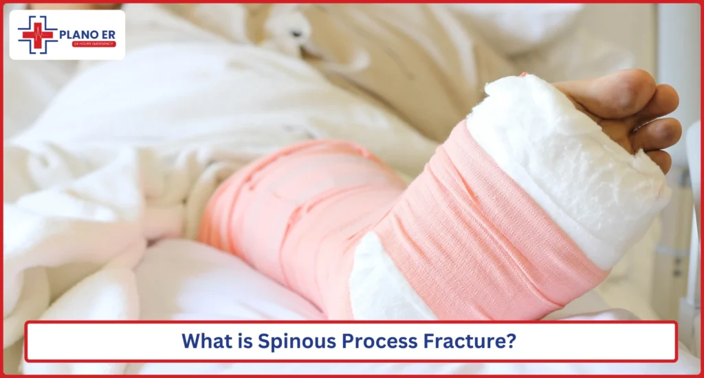What is Spinous Process Fracture