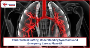 Peribronchial Cuffing Understanding Symptoms