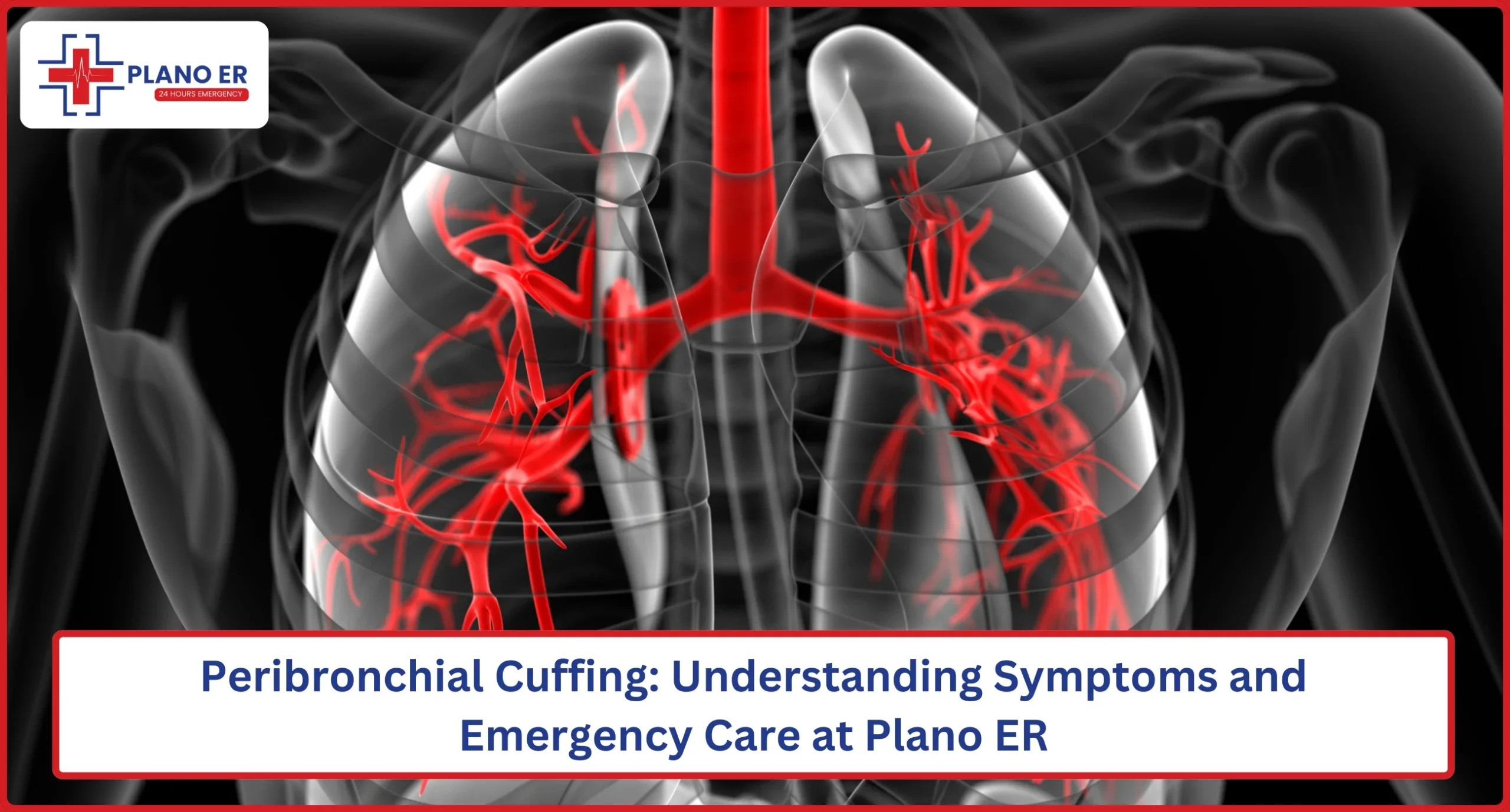 Peribronchial Cuffing Understanding Symptoms