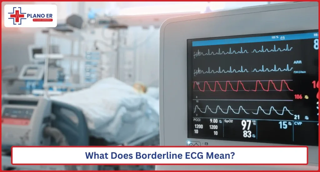 What Does Borderline ECG Mean