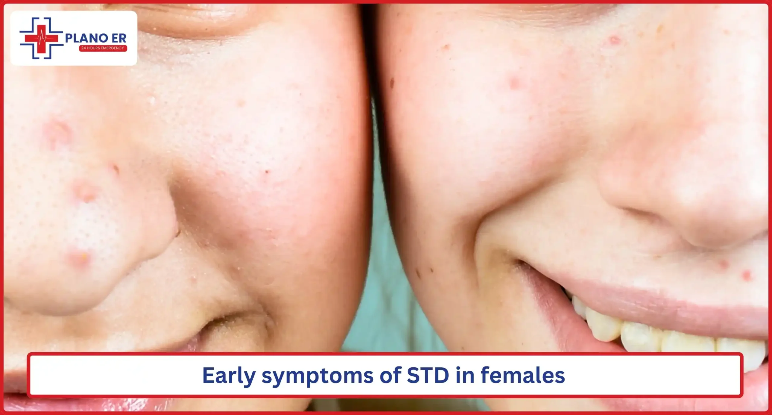 Early symptoms of STD in females