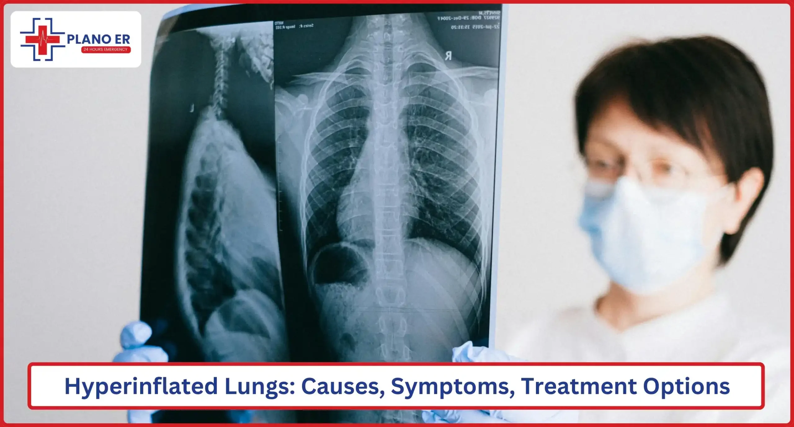Hyperinflated Lungs Causes, Symptoms, and Treatment Options