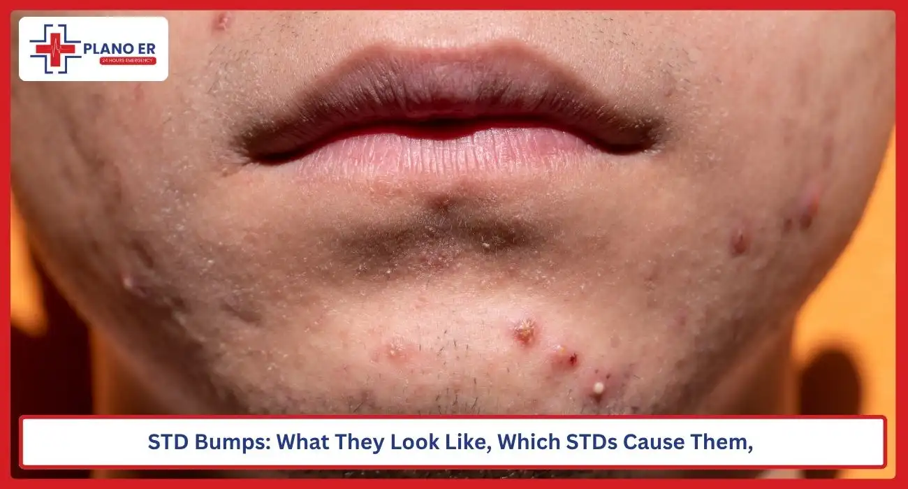 STD Bumps What They Look Like, Which STDs Cause Them, and What Else They Could Be