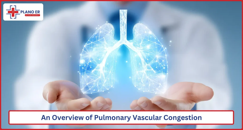 An Overview of Pulmonary Vascular Congestion