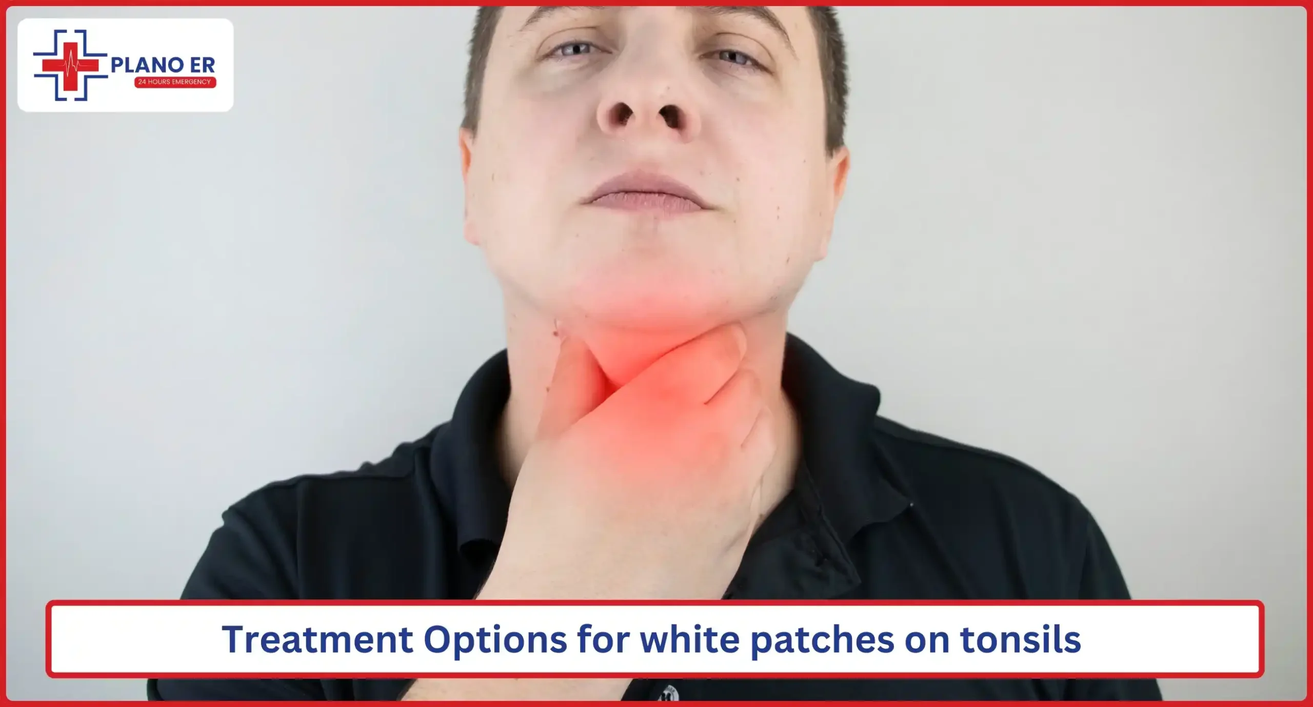 Treatment Options for white patches on tonsils