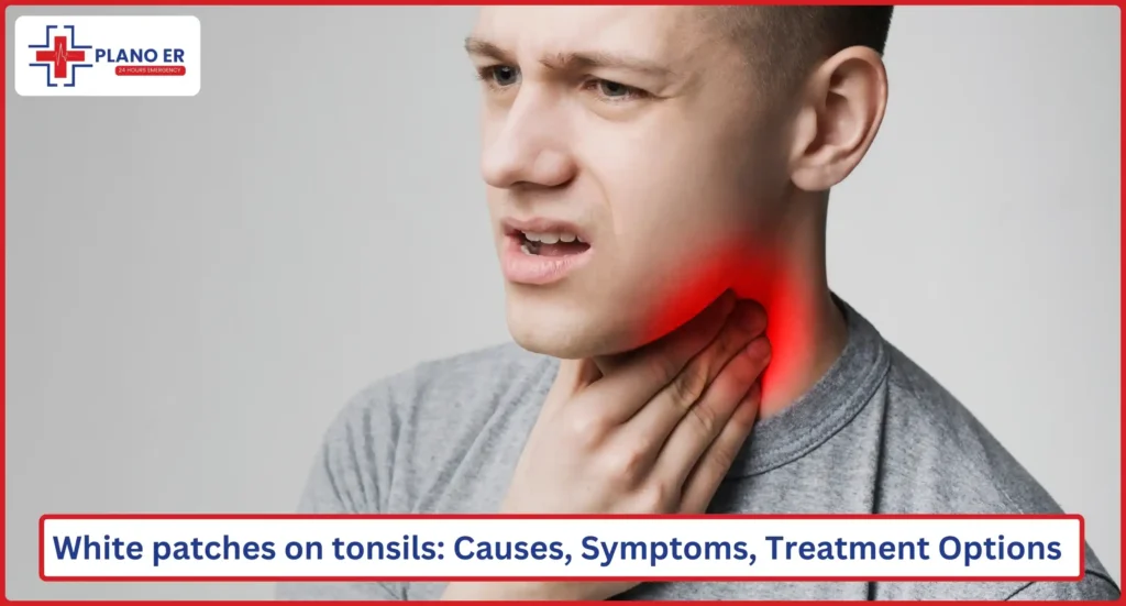 White patches on tonsils Causes, Symptoms, Treatment Options