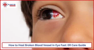 How to Heal Broken Blood Vessel in Eye Fast ER Care Guide