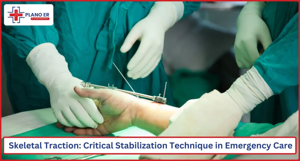 Skeletal Traction A Critical Stabilization Technique Used in Emergency Care