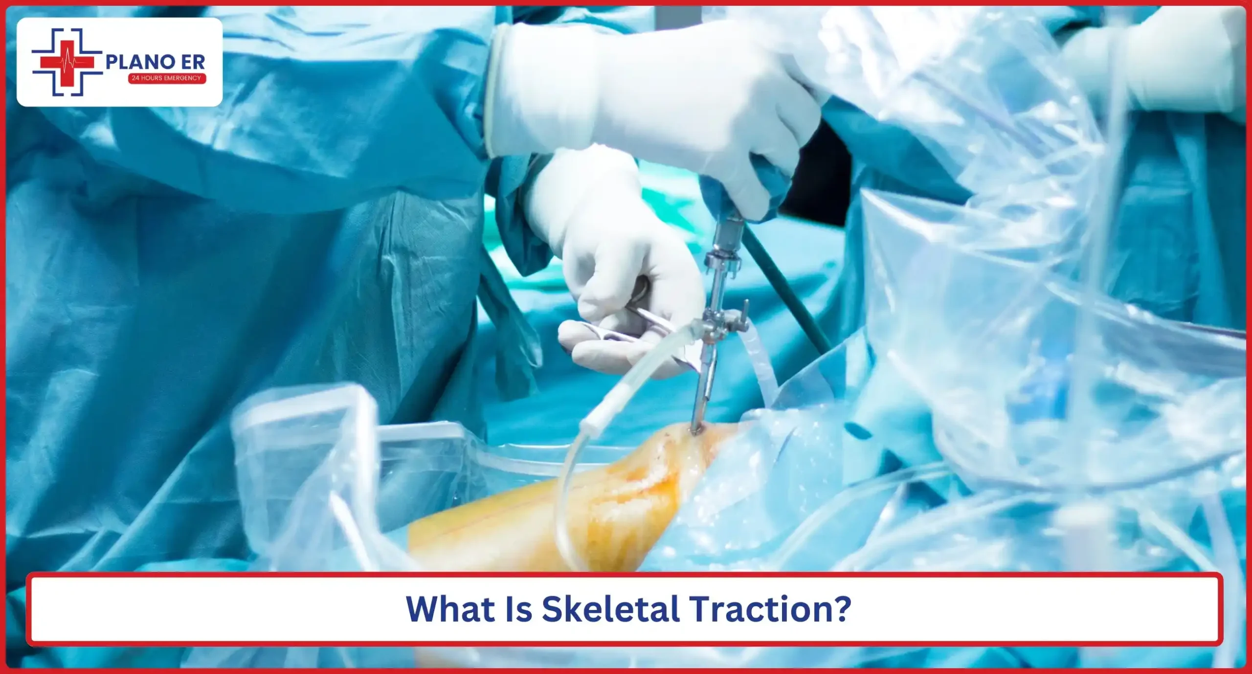 What Is Skeletal Traction