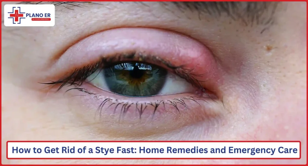 How to Get Rid of a Stye Fast Home Remedies and Emergency Care