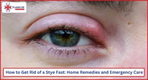 How to Get Rid of a Stye Fast Home Remedies and Emergency Care