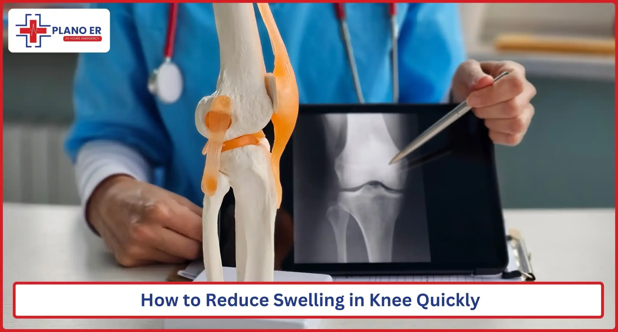 How to Reduce Swelling in Knee Quickly