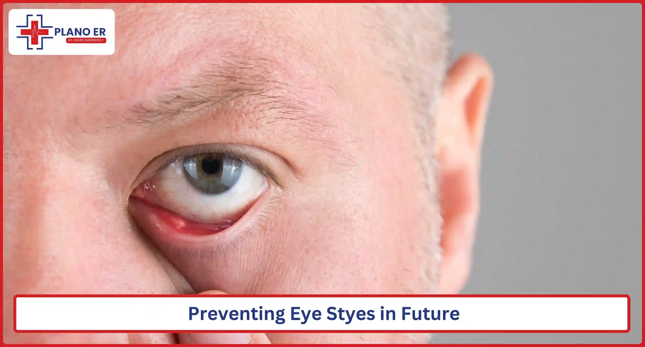 Preventing Eye Styes in Future