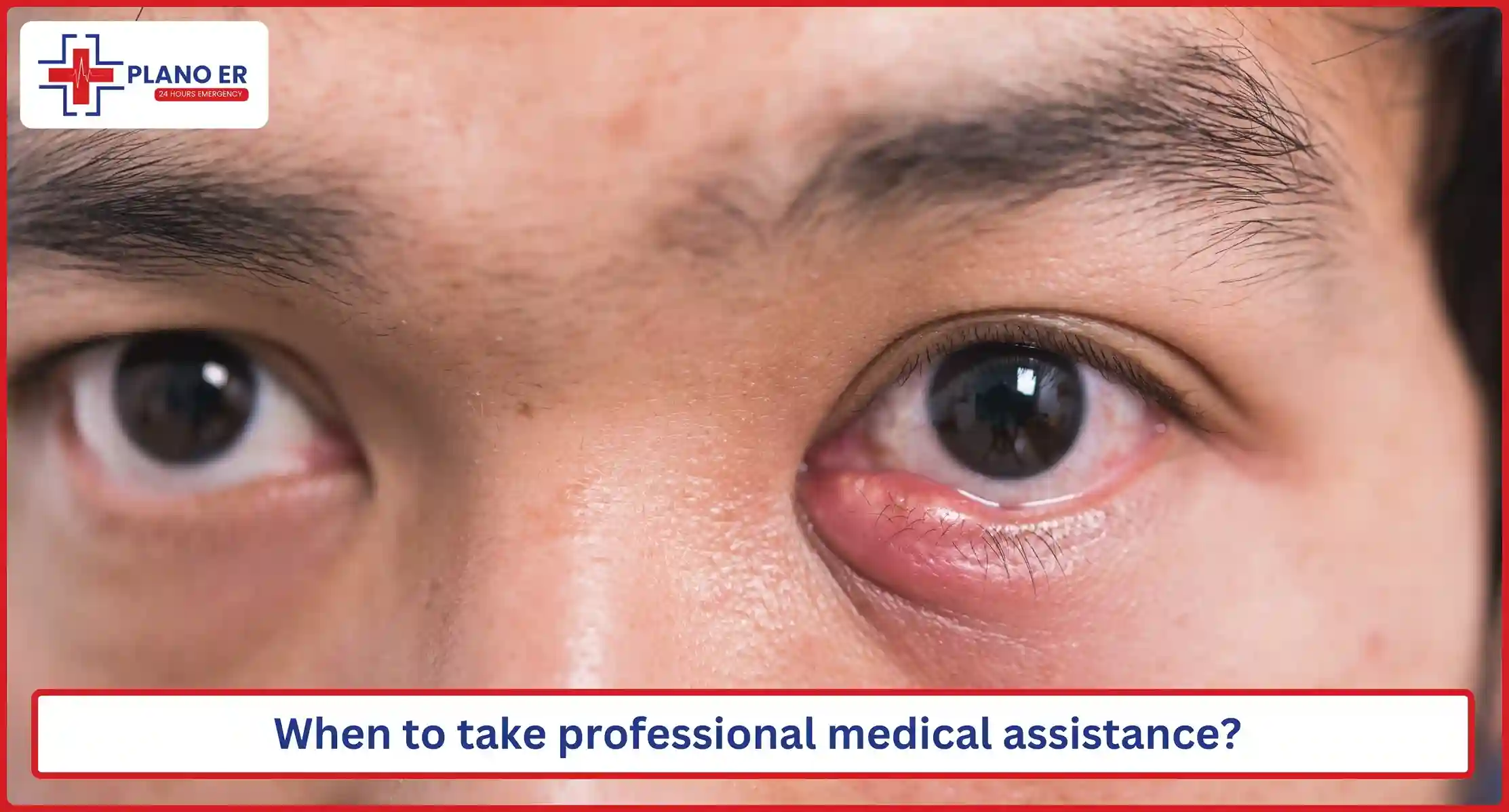 When to take professional medical assistance