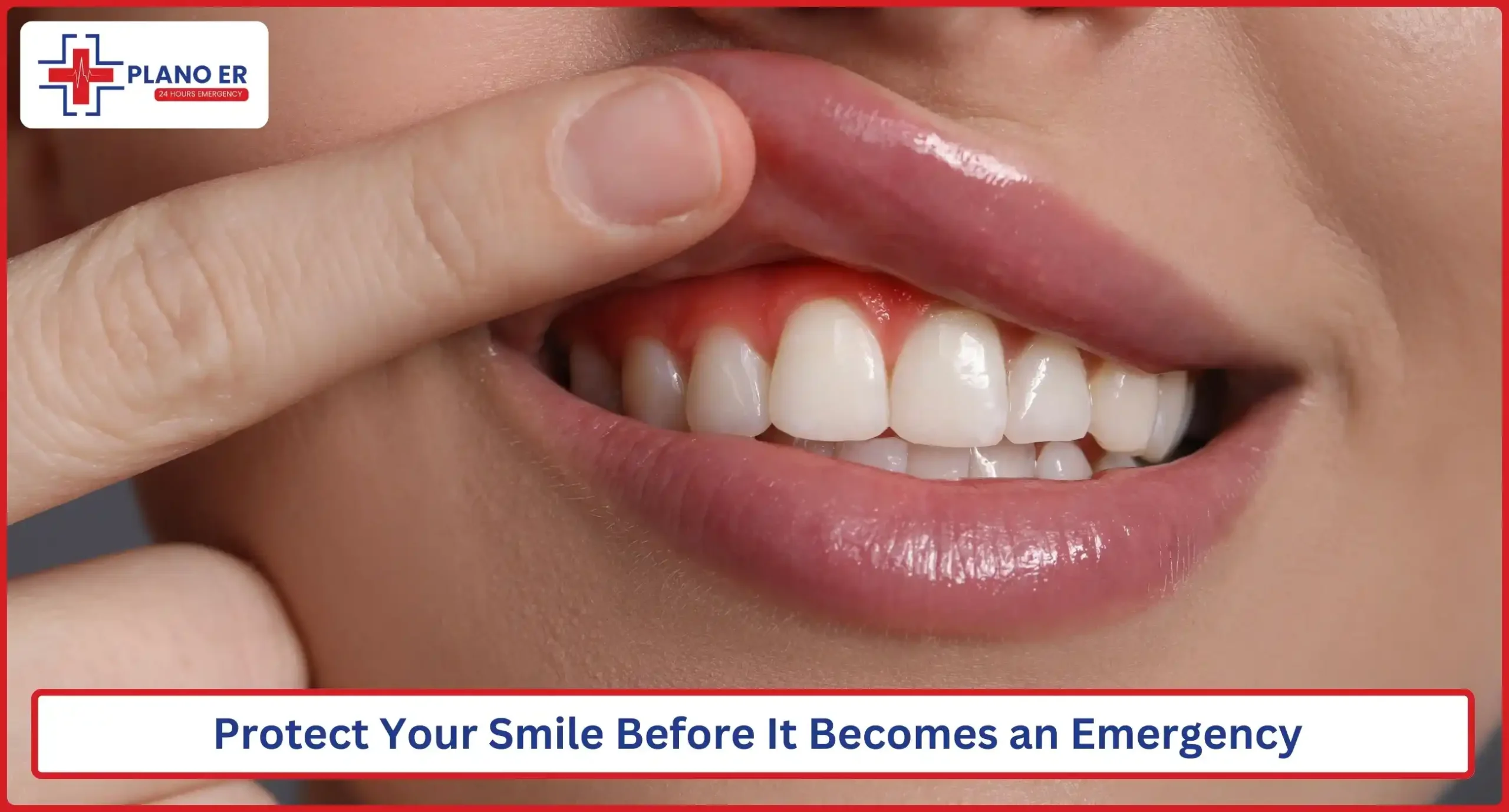 Protect Your Smile Before It Becomes an Emergency