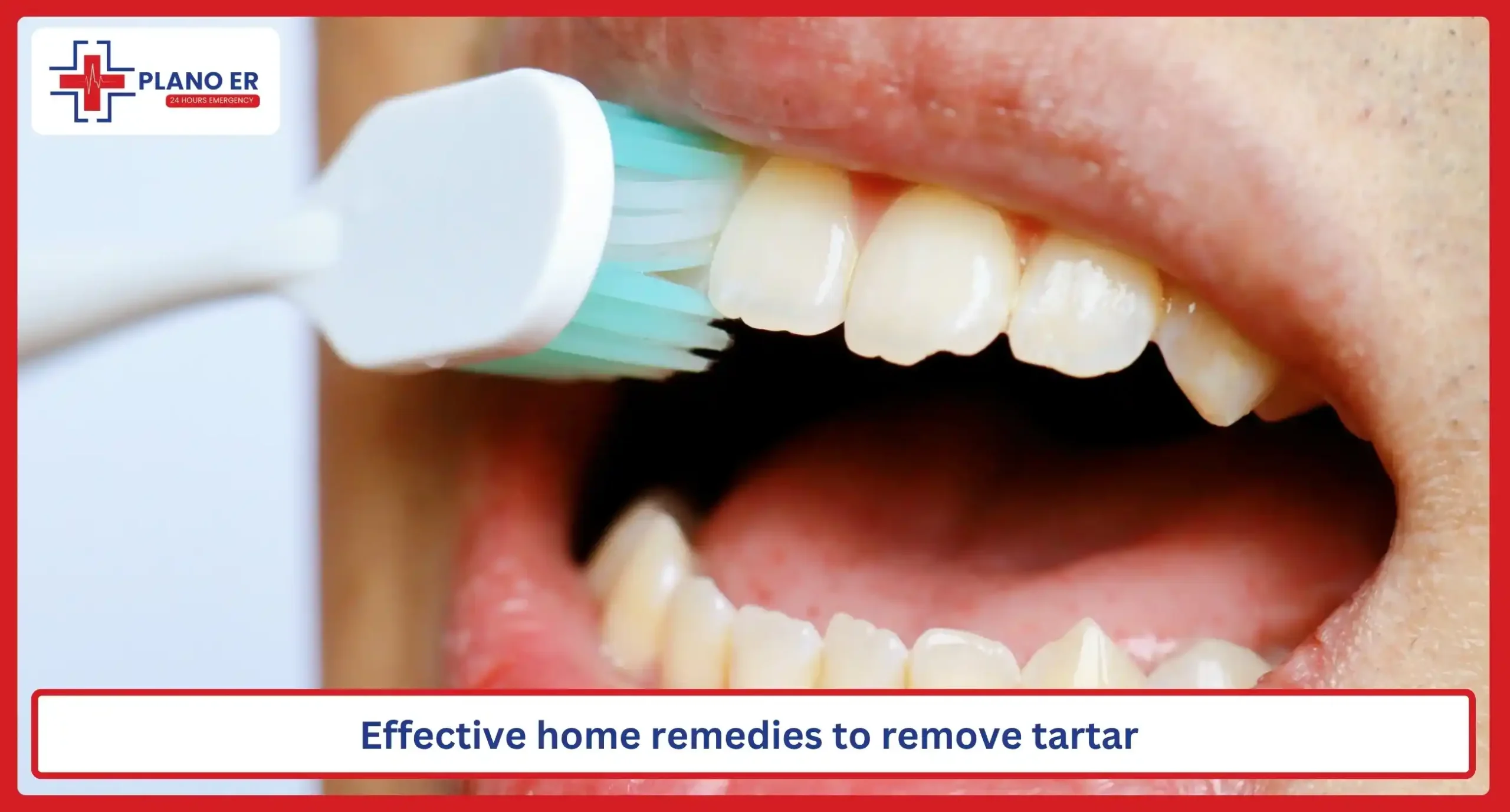 Effective home remedies to remove tartar