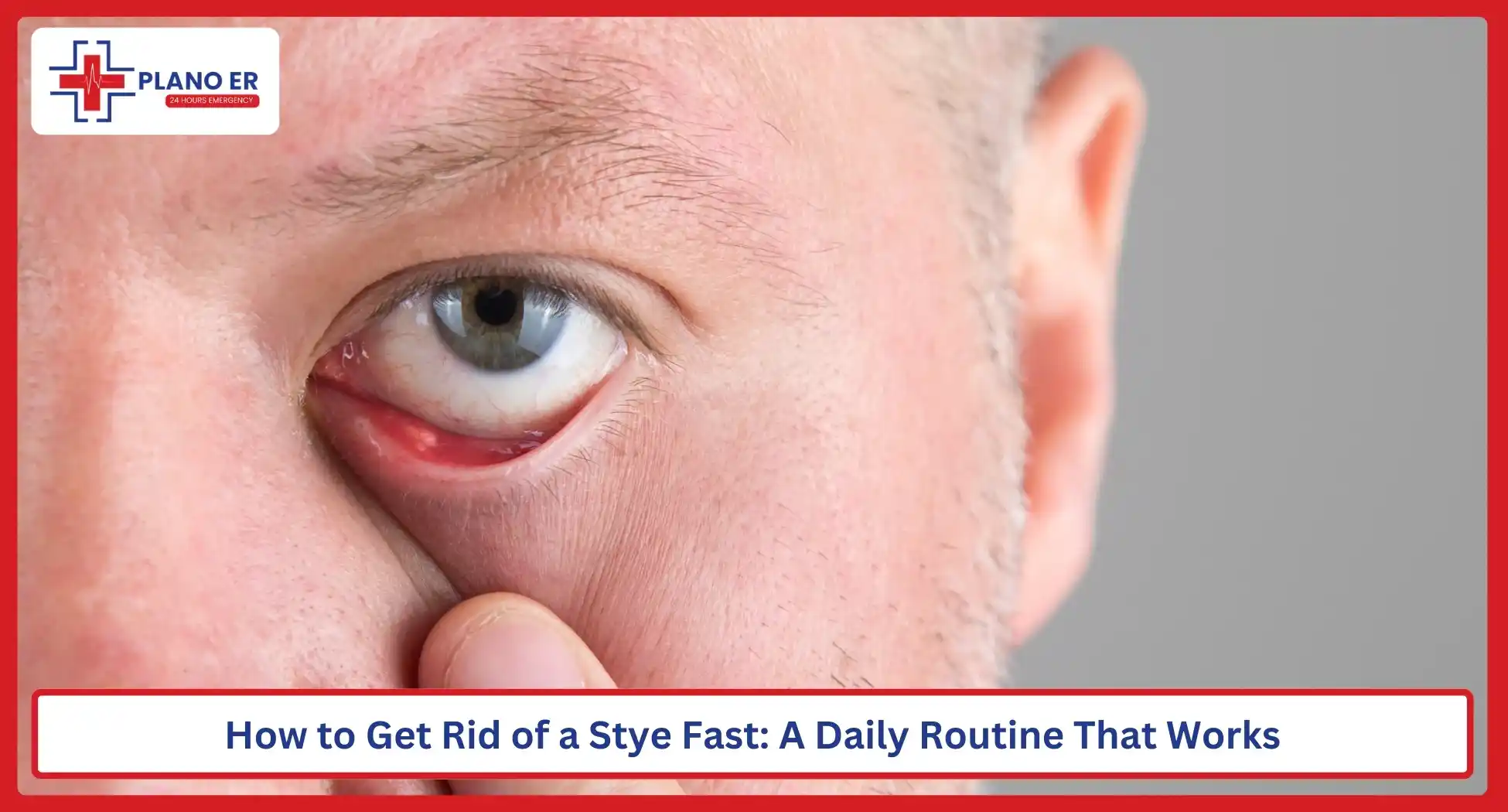 How to Get Rid of a Stye Fast A Daily Routine That Works