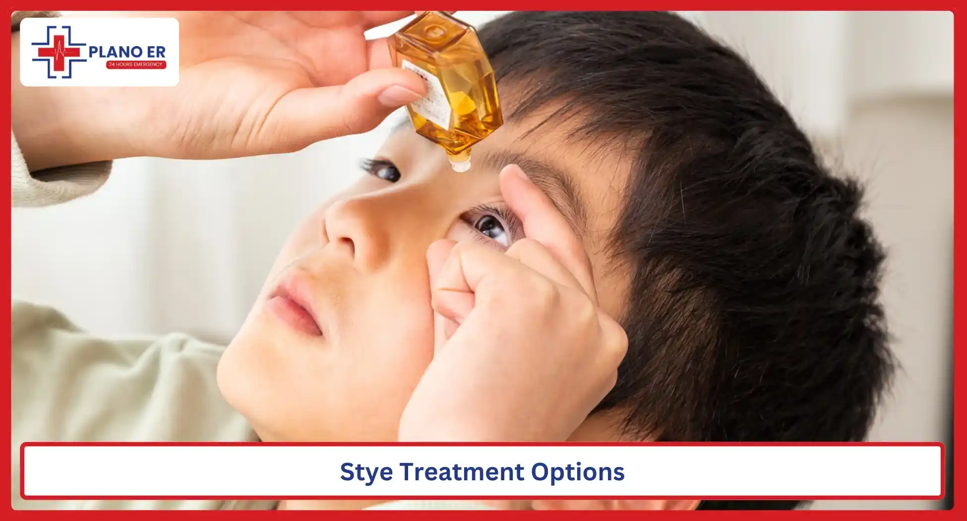 Stye Treatment Options