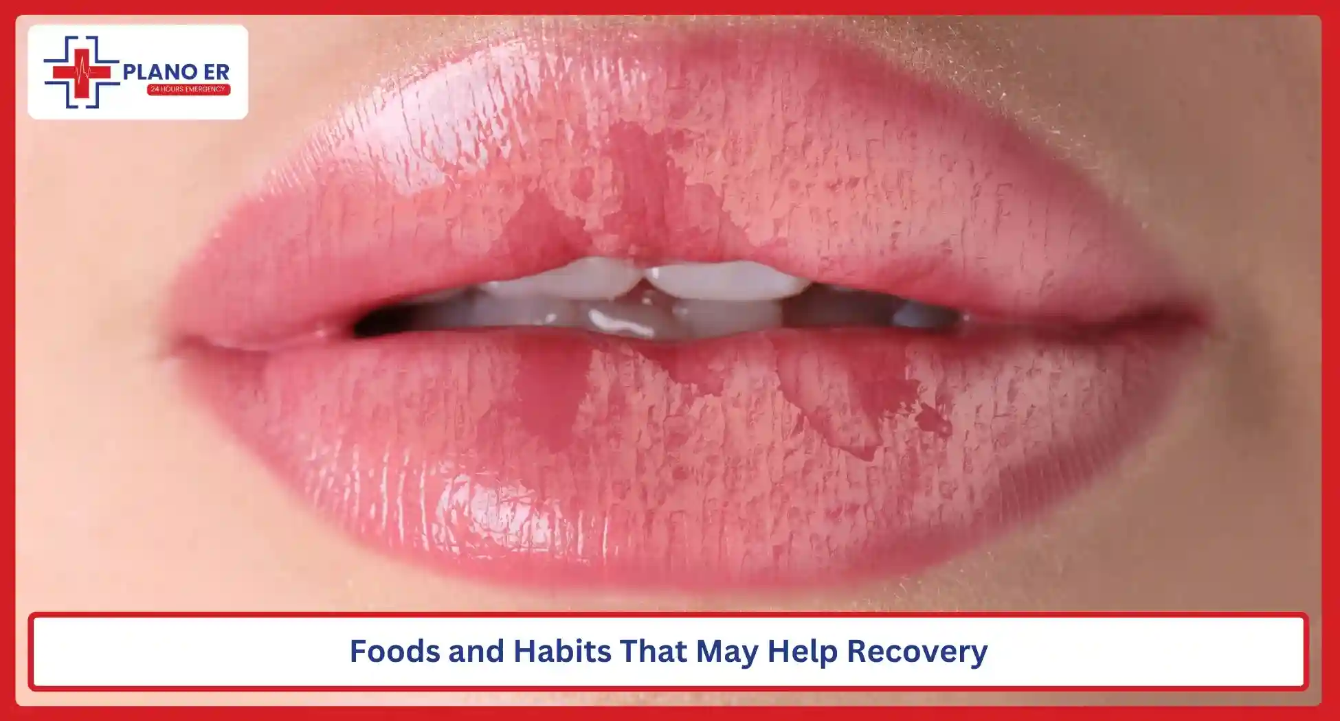 Foods and Habits That May Help Recovery
