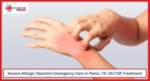 Severe Allergic Reaction Emergency Care in Plano, TX
