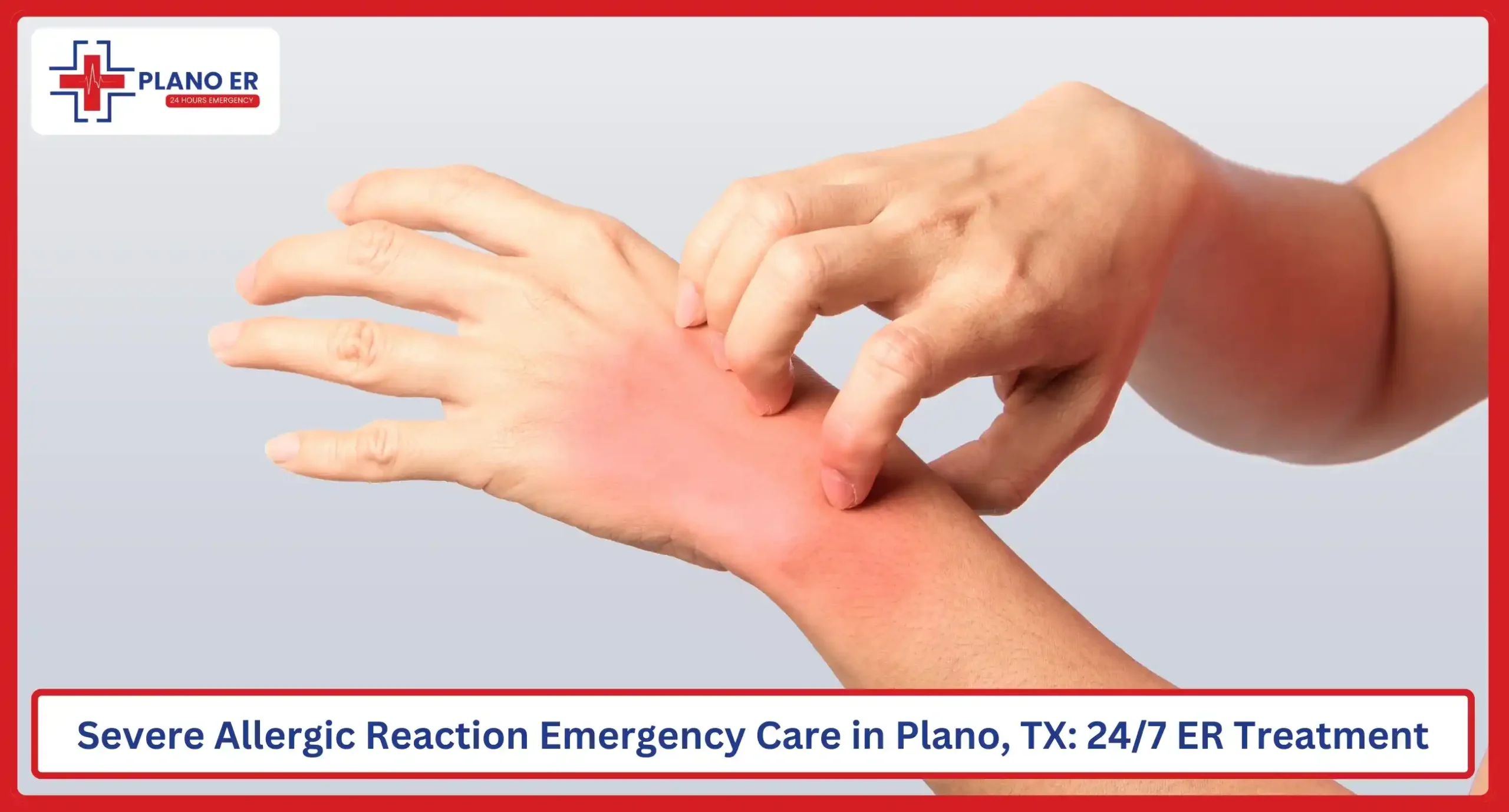 Severe Allergic Reaction Emergency Care in Plano, TX
