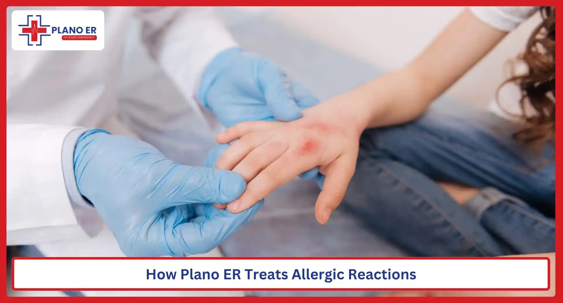 How Plano ER Treats Allergic Reactions