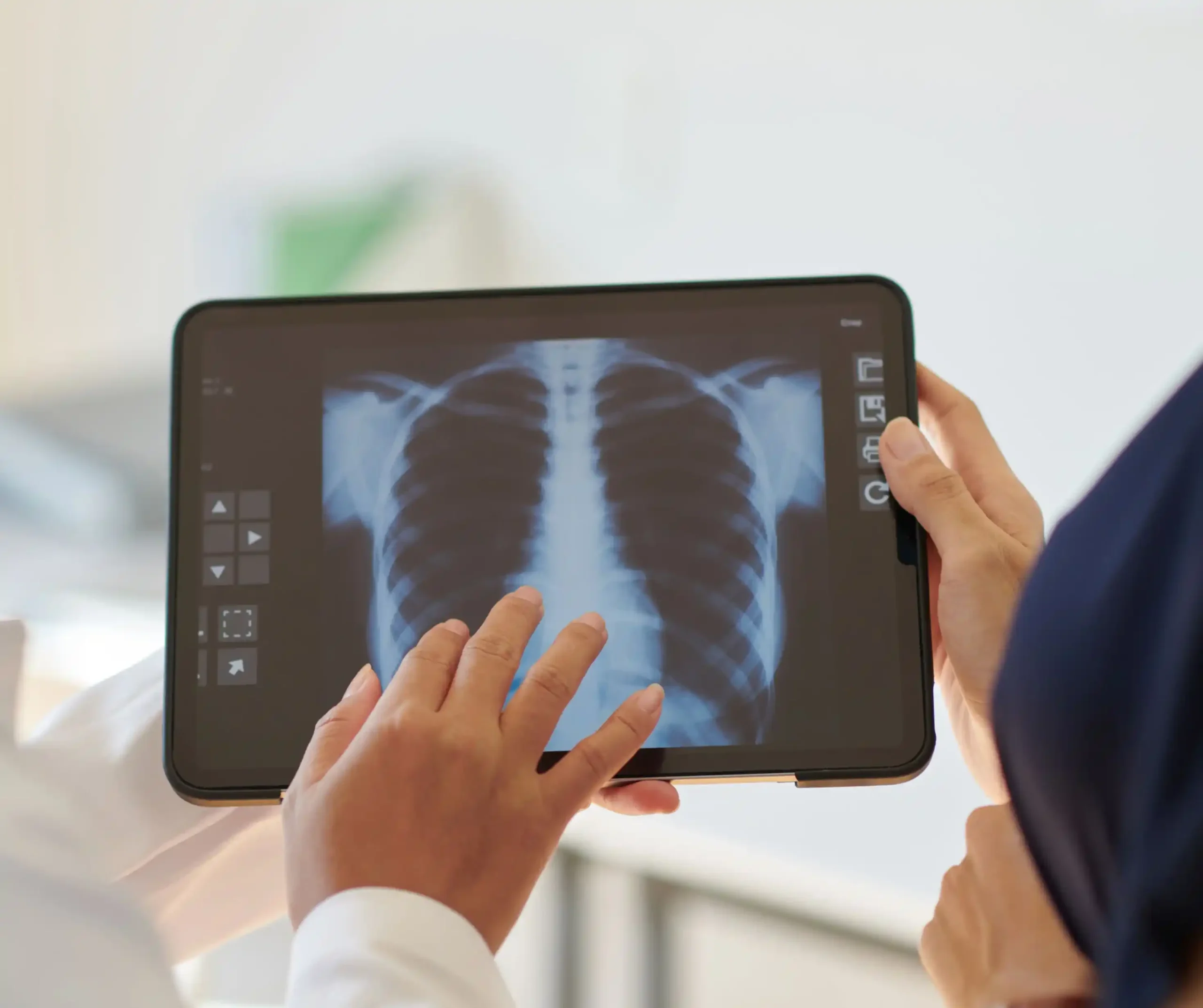 chest x-ray