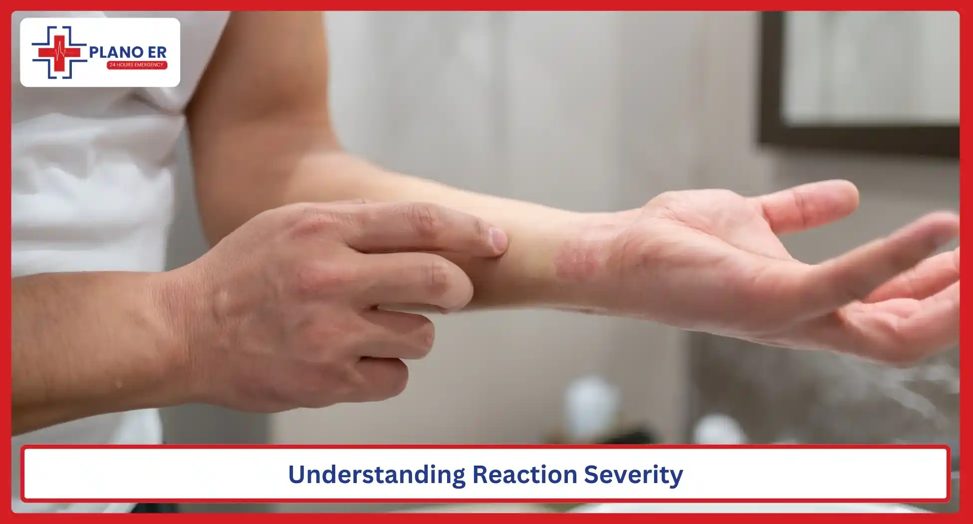 Understanding Reaction Severity