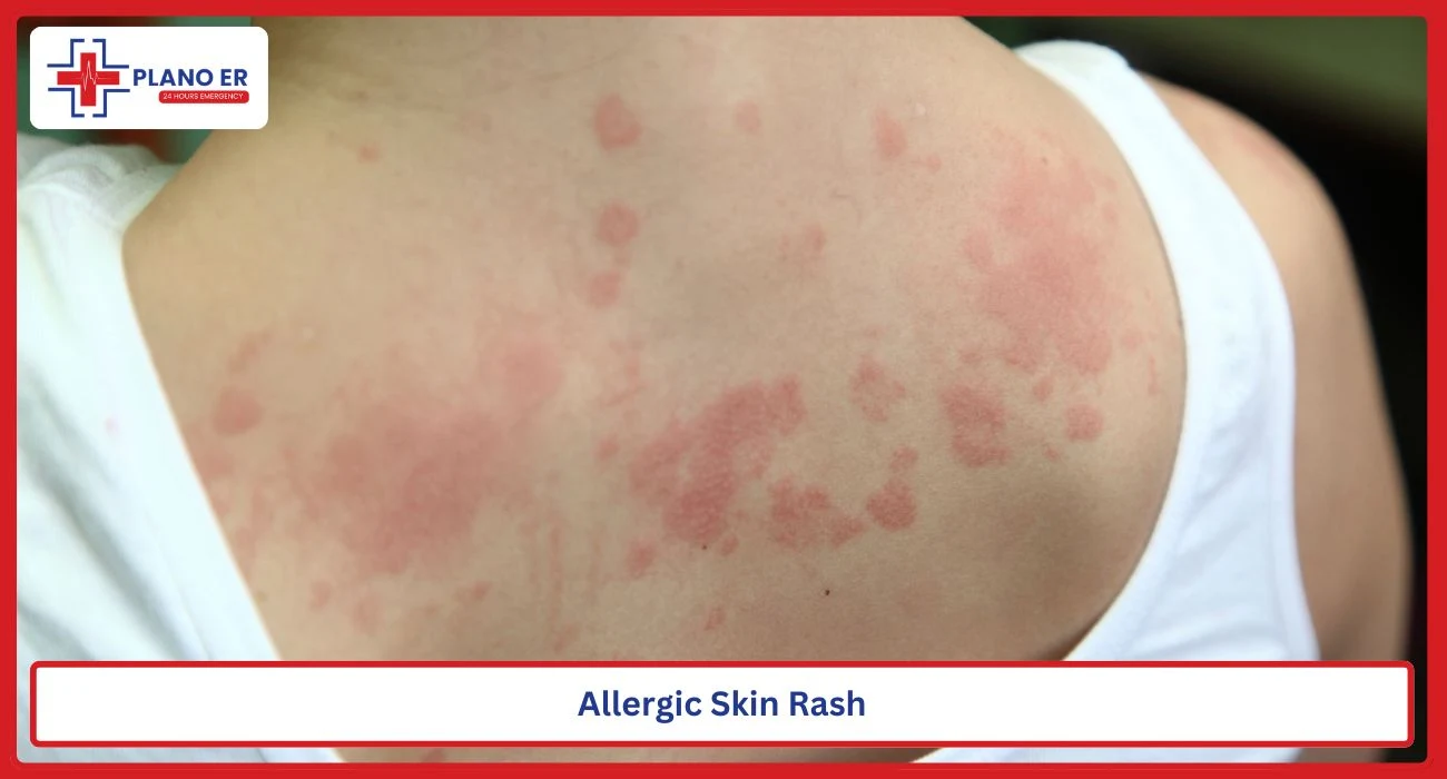 Person with an allergic skin rash and irritated skin