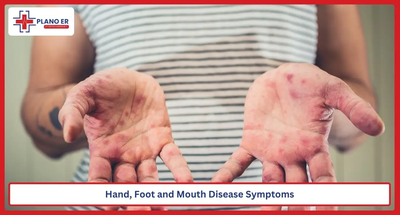 Hand, Foot and Mouth Disease Symptoms