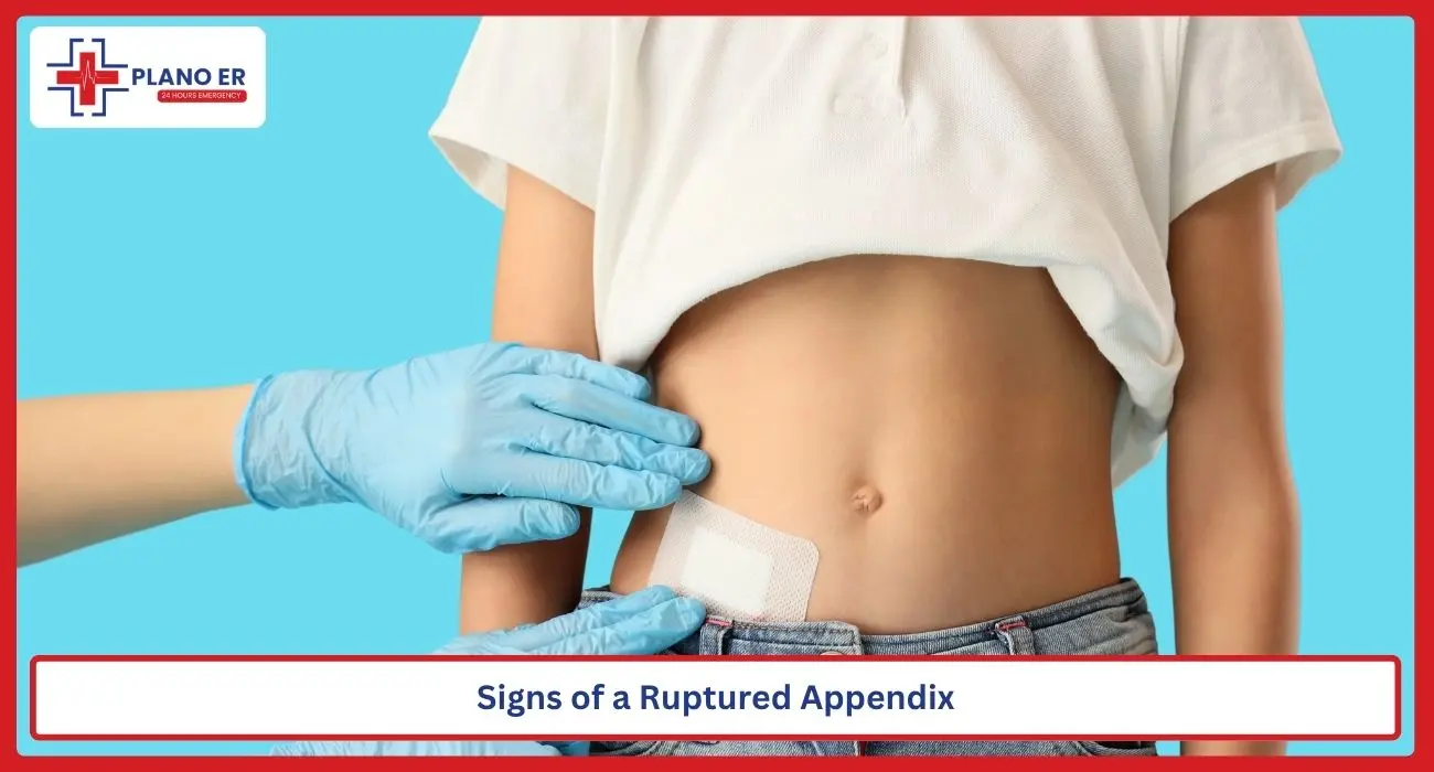 Signs of a Ruptured Appendix