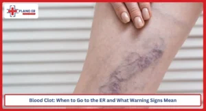 Blood Clot: When to Go to the ER and What Warning Signs Mean