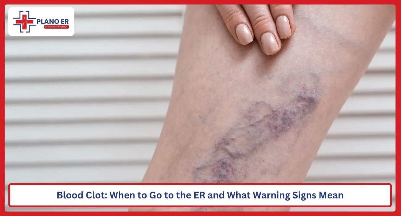 Blood Clot: When to Go to the ER and What Warning Signs Mean
